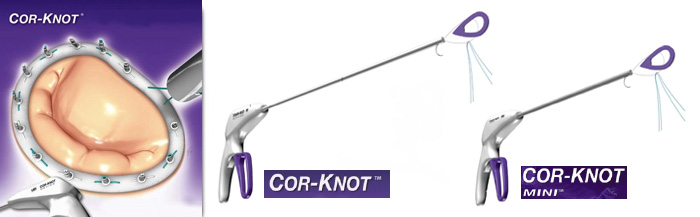 Cor-Knot